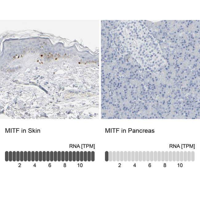 MiTF Antibody in Immunohistochemistry (Paraffin) (IHC (P))