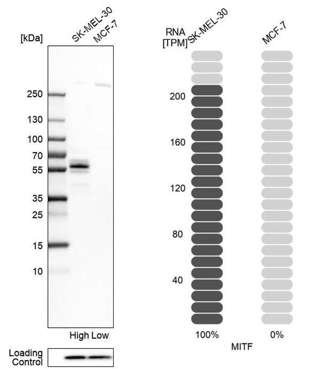 MiTF Polyclonal Antibody (PA582074)