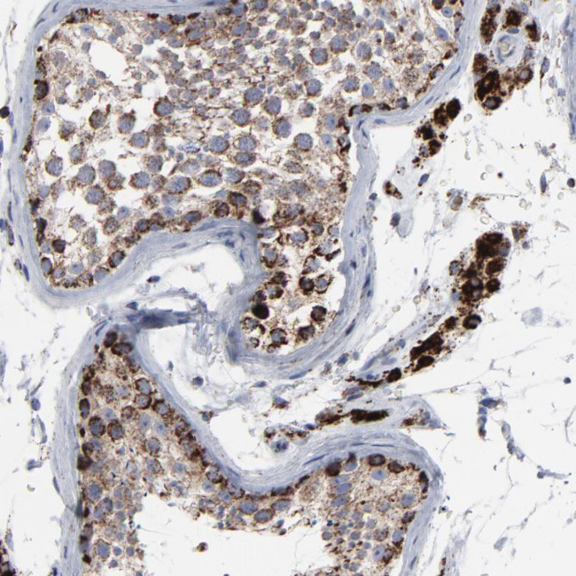 TrxR2 Antibody in Immunohistochemistry (Paraffin) (IHC (P))
