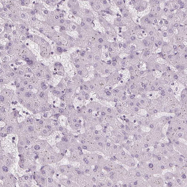 TFF1 Antibody in Immunohistochemistry (Paraffin) (IHC (P))