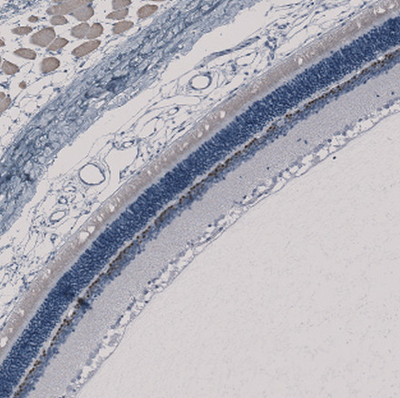 CHX10 Antibody in Immunohistochemistry (Paraffin) (IHC (P))