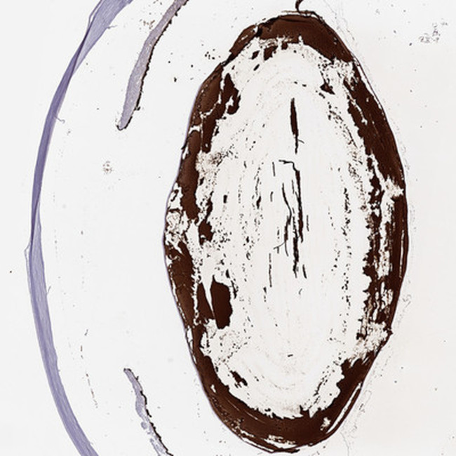 CRYBB1 Antibody in Immunohistochemistry (Paraffin) (IHC (P))