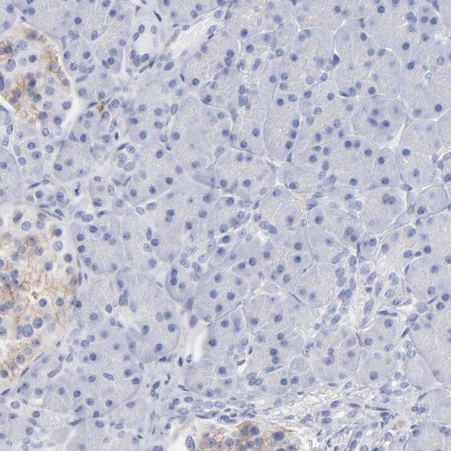 NTAL Antibody in Immunohistochemistry (Paraffin) (IHC (P))