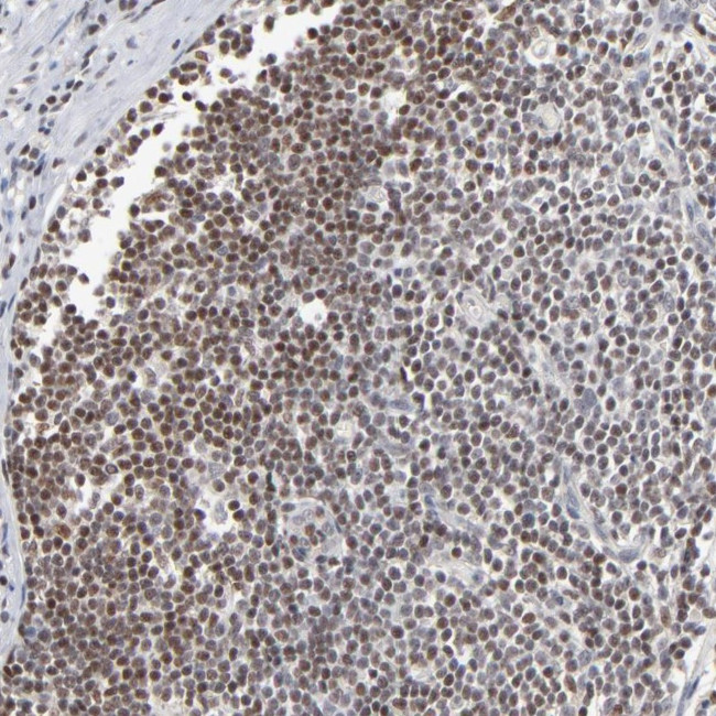 MAX Antibody in Immunohistochemistry (Paraffin) (IHC (P))