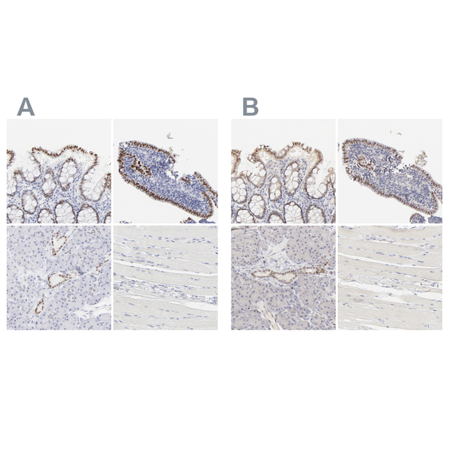 ELF3 Antibody in Immunohistochemistry (Paraffin) (IHC (P))