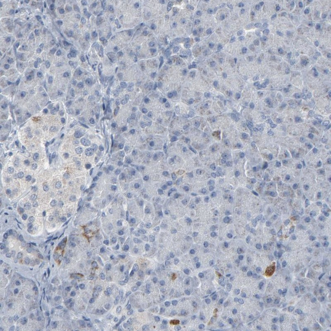 GPX2 Antibody in Immunohistochemistry (Paraffin) (IHC (P))