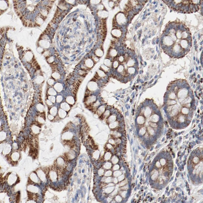 SETD3 Antibody in Immunohistochemistry (Paraffin) (IHC (P))