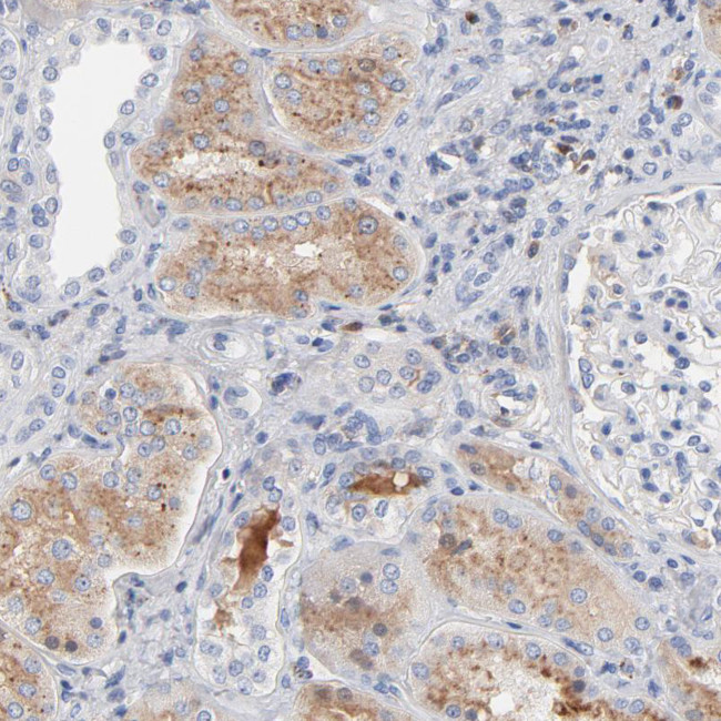 SERPINA4 Antibody in Immunohistochemistry (Paraffin) (IHC (P))