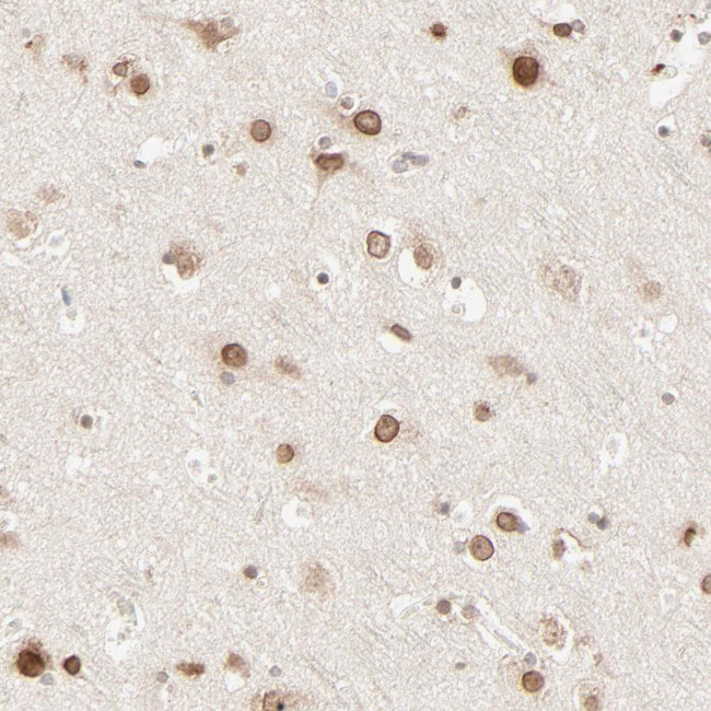 MAD1 Antibody in Immunohistochemistry (Paraffin) (IHC (P))