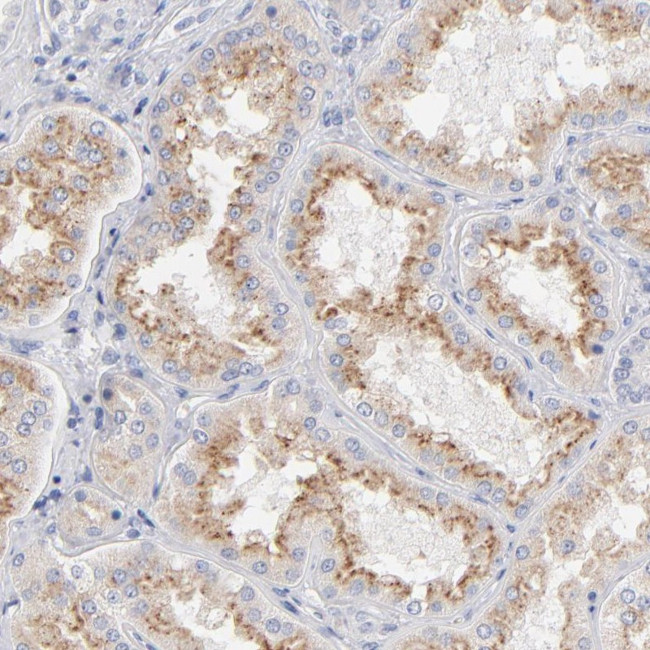 Factor XII Antibody in Immunohistochemistry (Paraffin) (IHC (P))