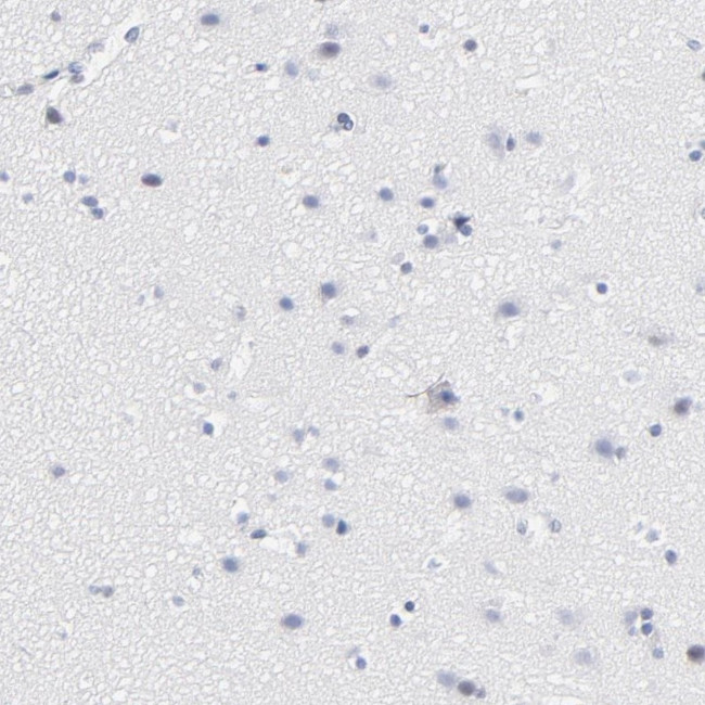 CD2 Antibody in Immunohistochemistry (Paraffin) (IHC (P))