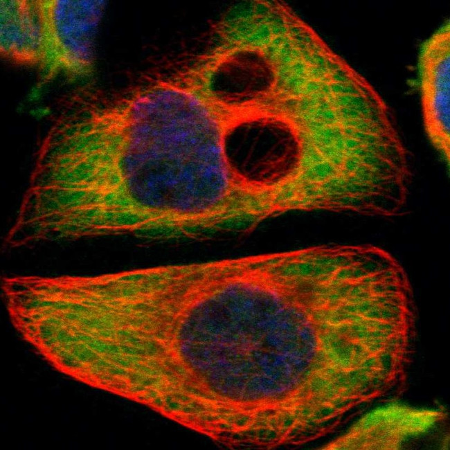 PI4K2B Antibody in Immunocytochemistry (ICC/IF)
