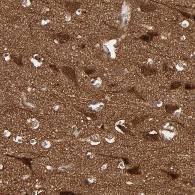 WAVE1 Antibody in Immunohistochemistry (Paraffin) (IHC (P))