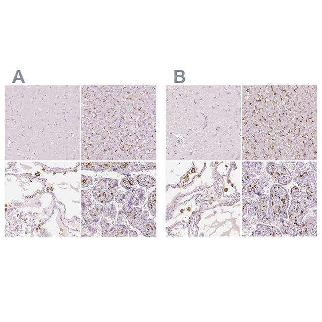 CD206 Antibody in Immunohistochemistry (Paraffin) (IHC (P))