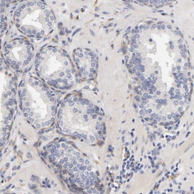Laminin beta-1 Antibody in Immunohistochemistry (Paraffin) (IHC (P))