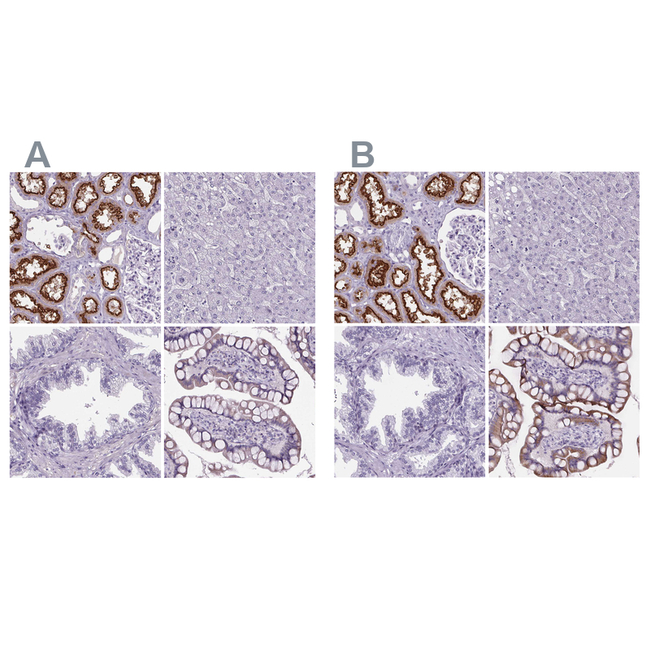 CUBN Antibody in Immunohistochemistry (Paraffin) (IHC (P))
