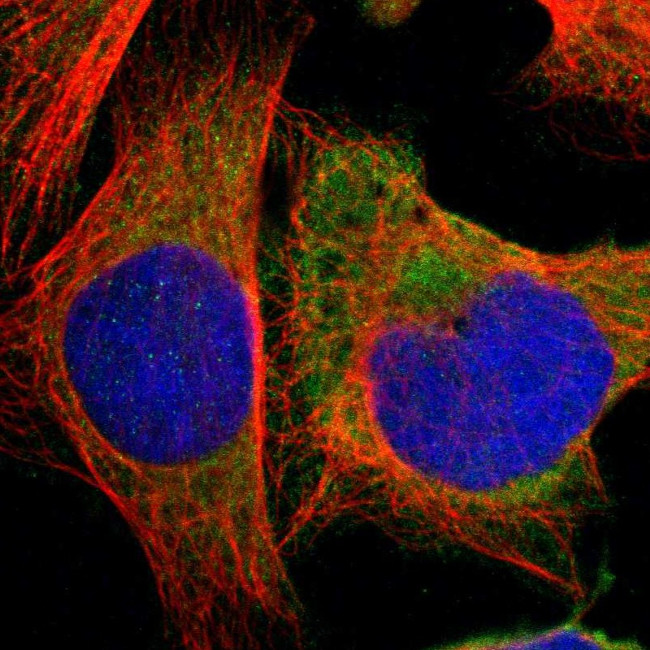 HDLBP Antibody in Immunocytochemistry (ICC/IF)