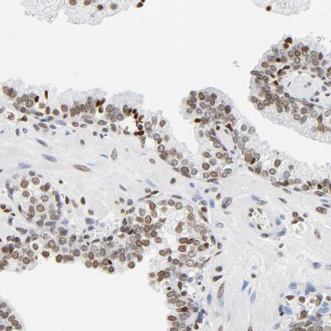 HOXA6 Antibody in Immunohistochemistry (Paraffin) (IHC (P))