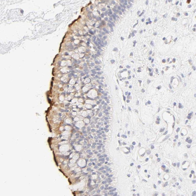 CYP4B1 Antibody in Immunohistochemistry (Paraffin) (IHC (P))