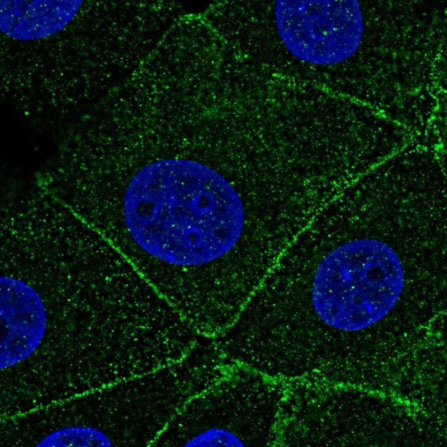 ARPC1A Antibody in Immunocytochemistry (ICC/IF)
