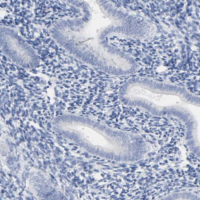 Prostate Specific Acid Phosphatase Antibody in Immunohistochemistry (Paraffin) (IHC (P))
