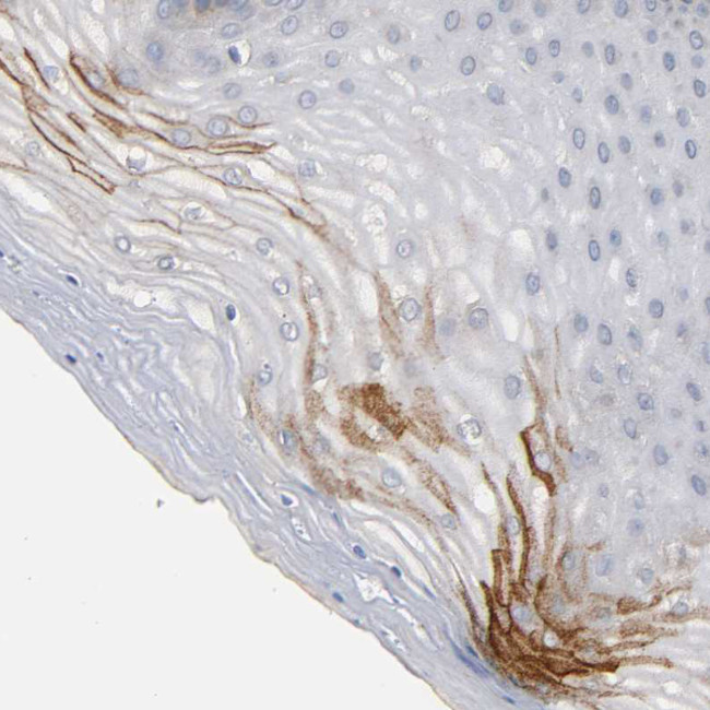 IFITM3 Antibody in Immunohistochemistry (Paraffin) (IHC (P))