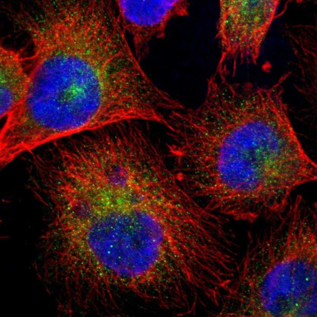 RhoGAP Antibody in Immunocytochemistry (ICC/IF)