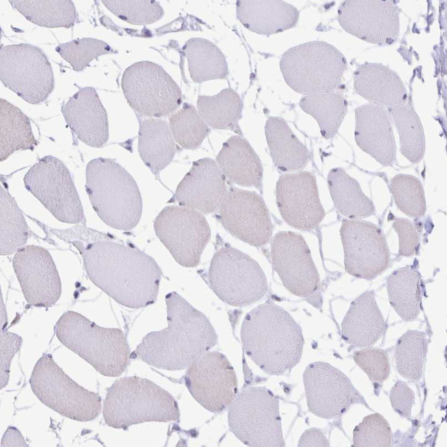 TGM3 Antibody in Immunohistochemistry (Paraffin) (IHC (P))