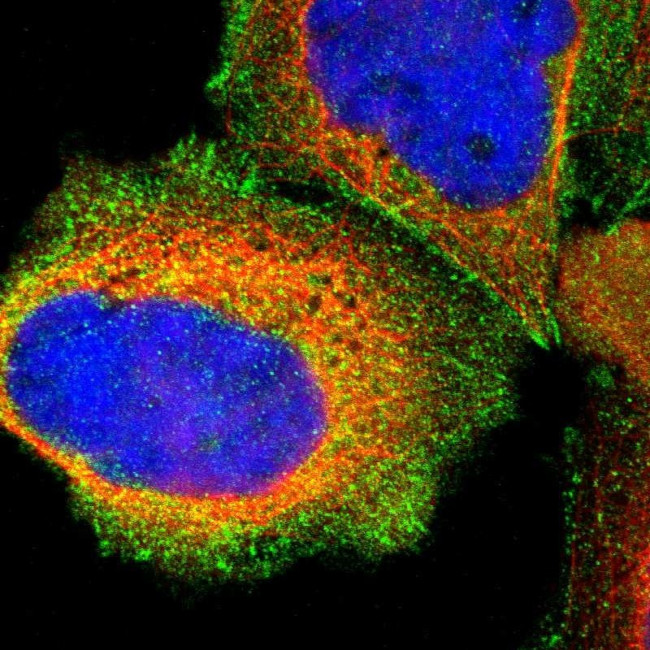 Talin 1 Antibody in Immunocytochemistry (ICC/IF)