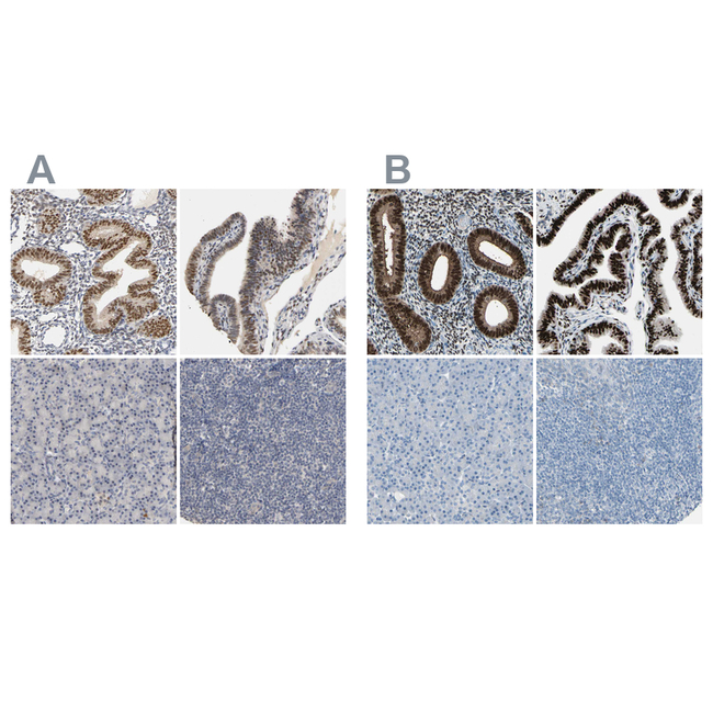 Progesterone Receptor Antibody in Immunohistochemistry (Paraffin) (IHC (P))