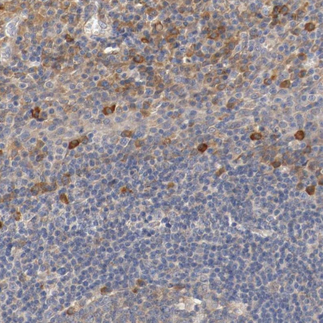 APRIL Antibody in Immunohistochemistry (Paraffin) (IHC (P))