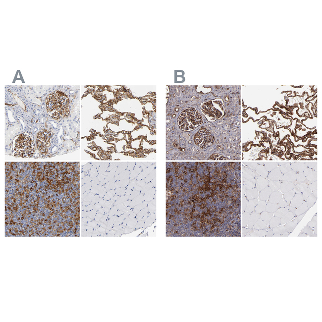 ICAM-1 Antibody in Immunohistochemistry (Paraffin) (IHC (P))
