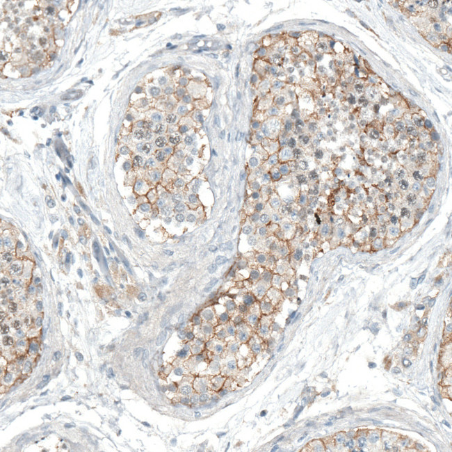 HTR1E Antibody in Immunohistochemistry (Paraffin) (IHC (P))