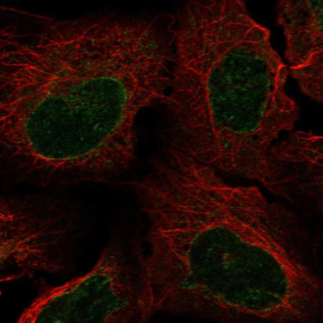 NUP62 Antibody in Immunocytochemistry (ICC/IF)