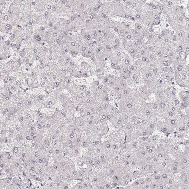 HNF4G Antibody in Immunohistochemistry (Paraffin) (IHC (P))