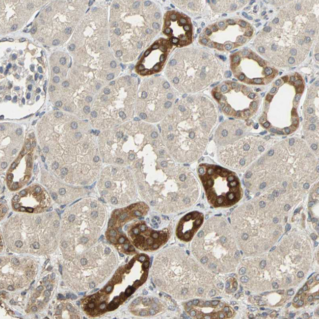 ACSL4 Antibody in Immunohistochemistry (Paraffin) (IHC (P))
