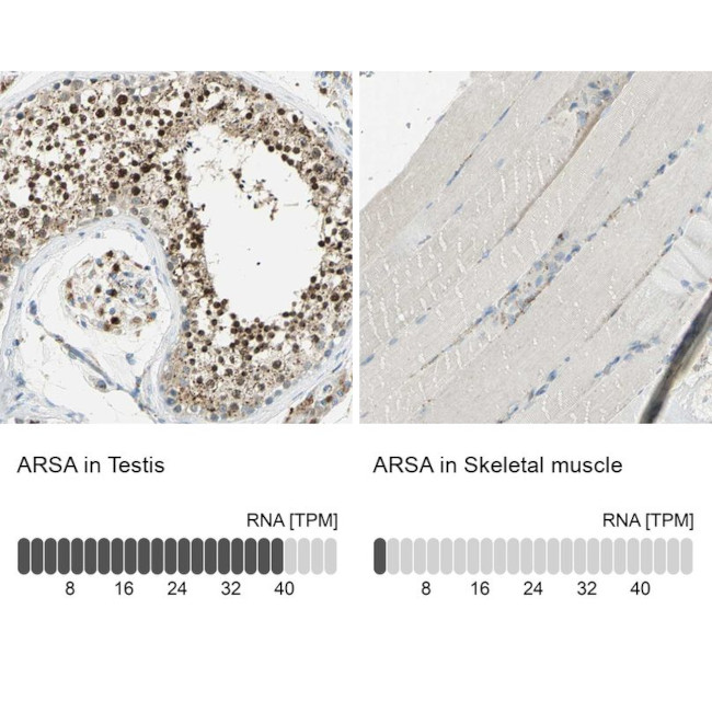 Arylsulfatase A Antibody