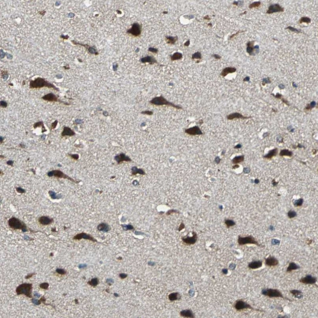 NSD3 Antibody in Immunohistochemistry (Paraffin) (IHC (P))
