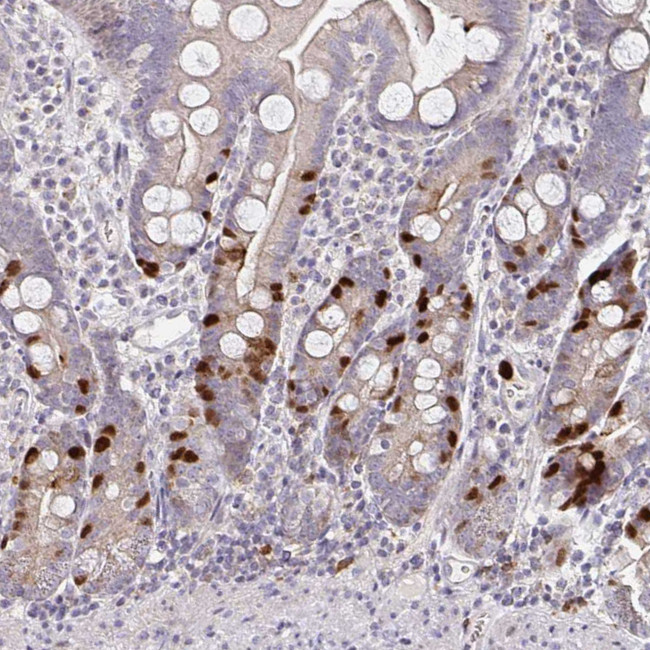 Anillin Antibody in Immunohistochemistry (Paraffin) (IHC (P))