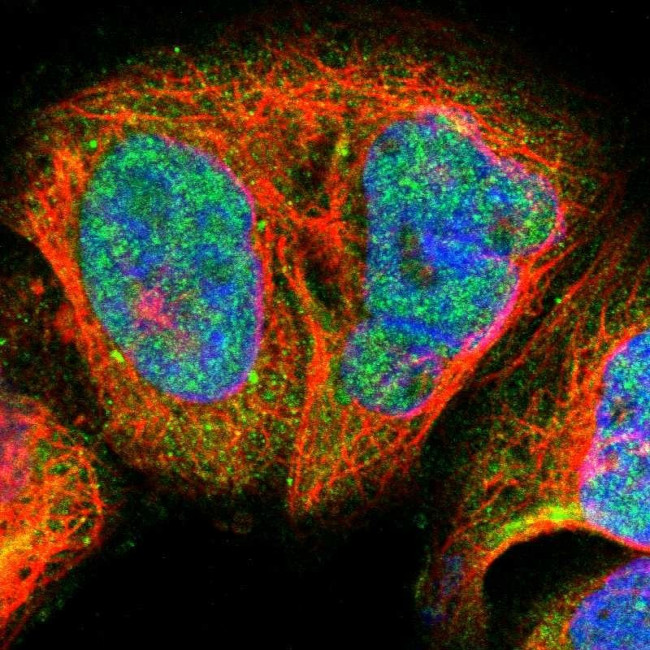Blooms Syndrome Antibody in Immunocytochemistry (ICC/IF)