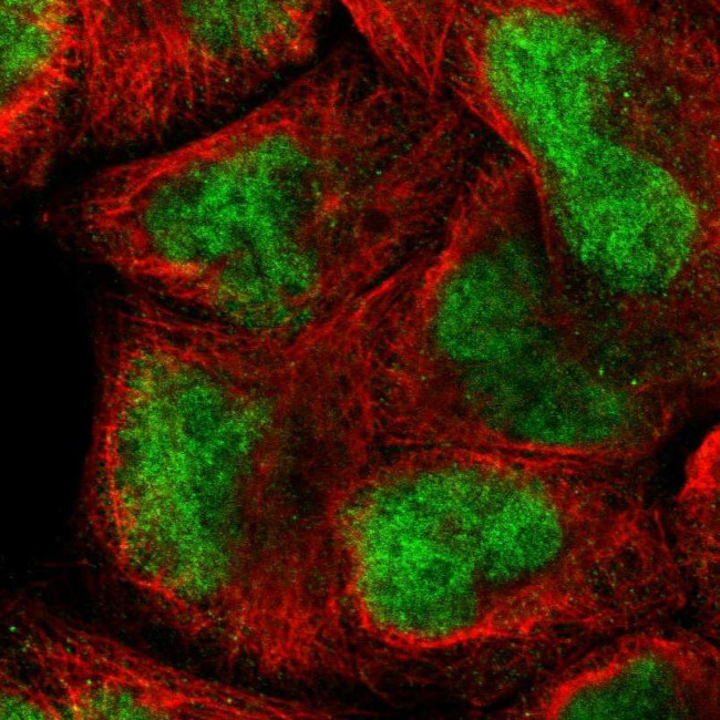 MLLT10 Antibody in Immunocytochemistry (ICC/IF)