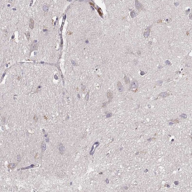GRAP2 Antibody in Immunohistochemistry (Paraffin) (IHC (P))