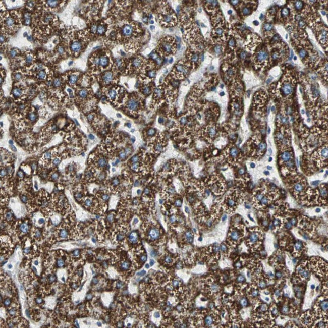 ECH1 Antibody in Immunohistochemistry (Paraffin) (IHC (P))