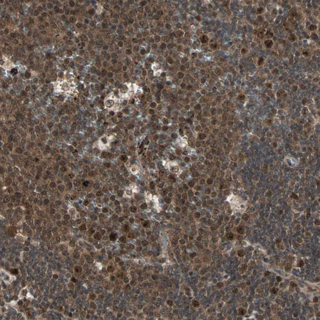 CK2 beta Antibody in Immunohistochemistry (Paraffin) (IHC (P))