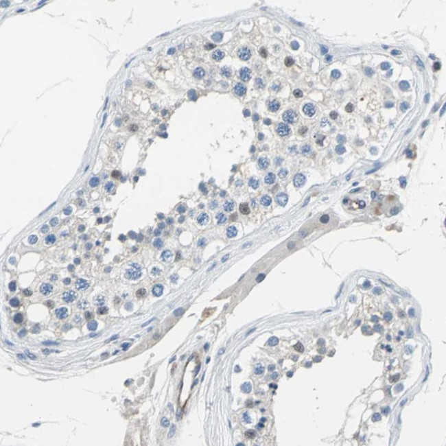 P-Selectin Antibody in Immunohistochemistry (Paraffin) (IHC (P))