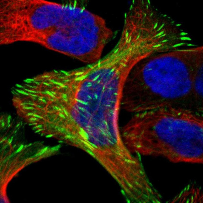 FHL2 Antibody in Immunocytochemistry (ICC/IF)