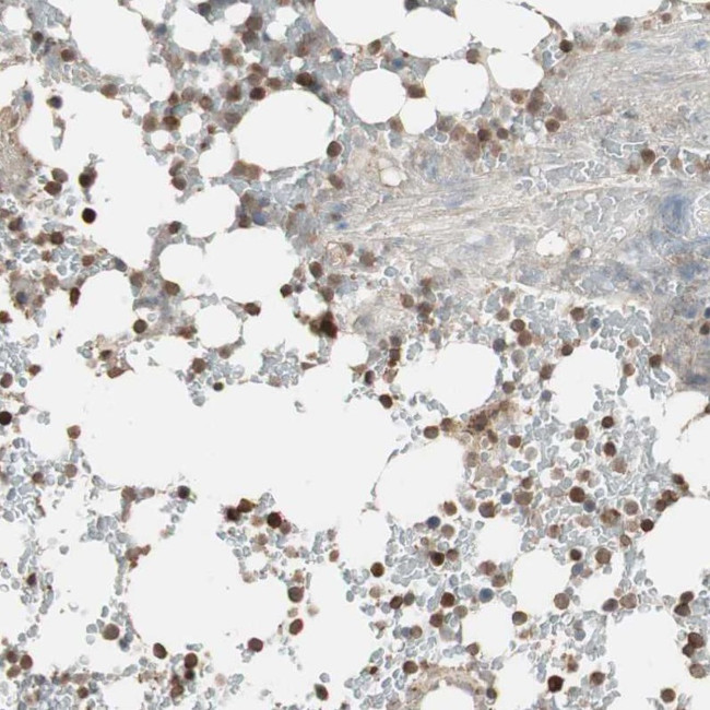 USP20 Antibody in Immunohistochemistry (Paraffin) (IHC (P))