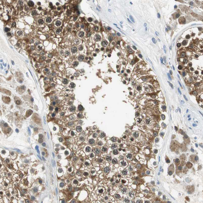 ME1 Antibody in Immunohistochemistry (Paraffin) (IHC (P))