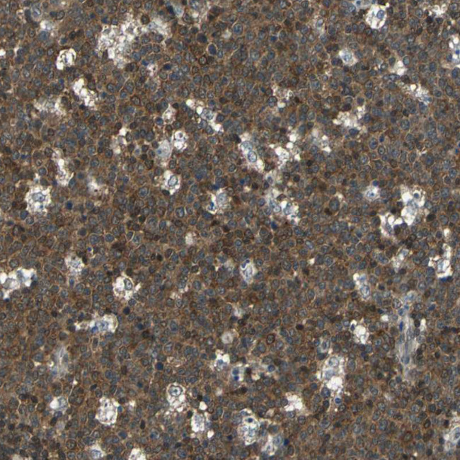 p21 ARC Antibody in Immunohistochemistry (Paraffin) (IHC (P))