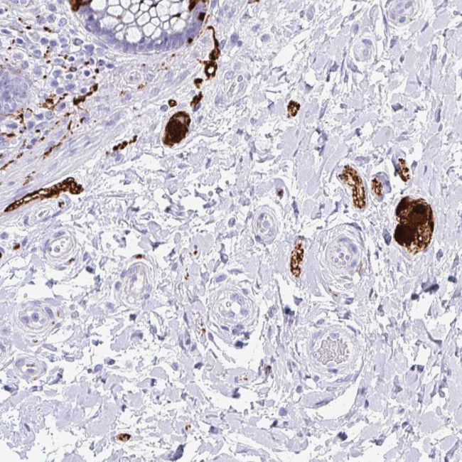 SCGN Antibody in Immunohistochemistry (Paraffin) (IHC (P))